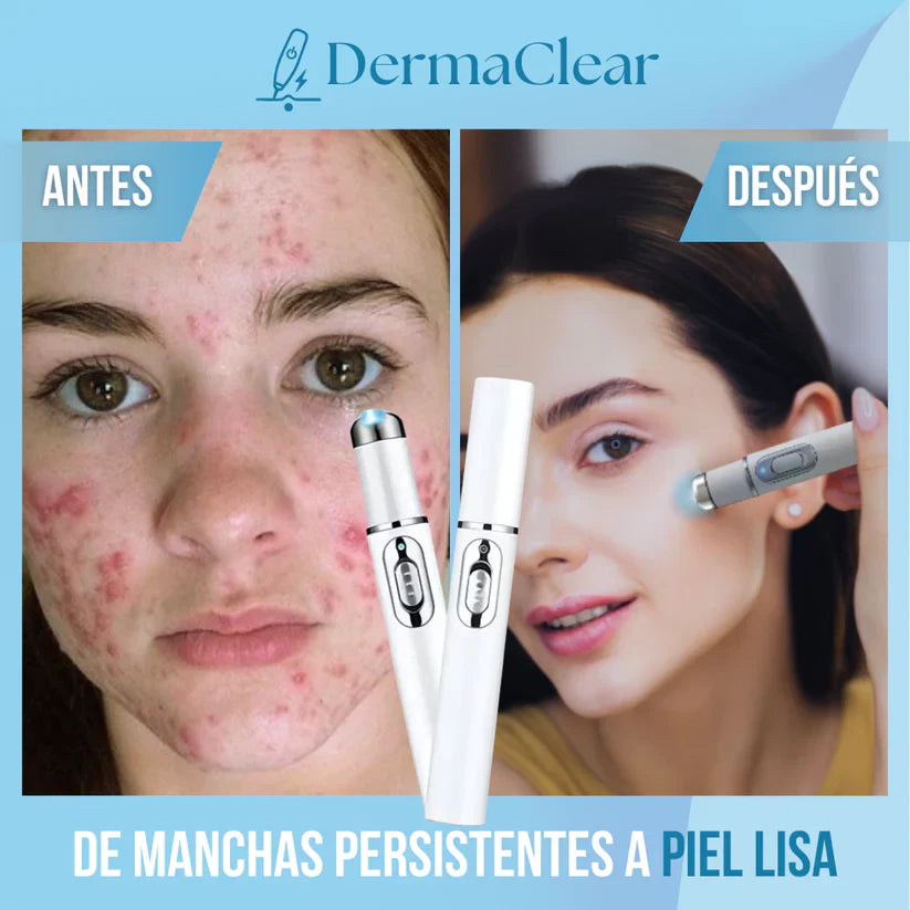 DermaClear - Borra Imperfecciones al instante