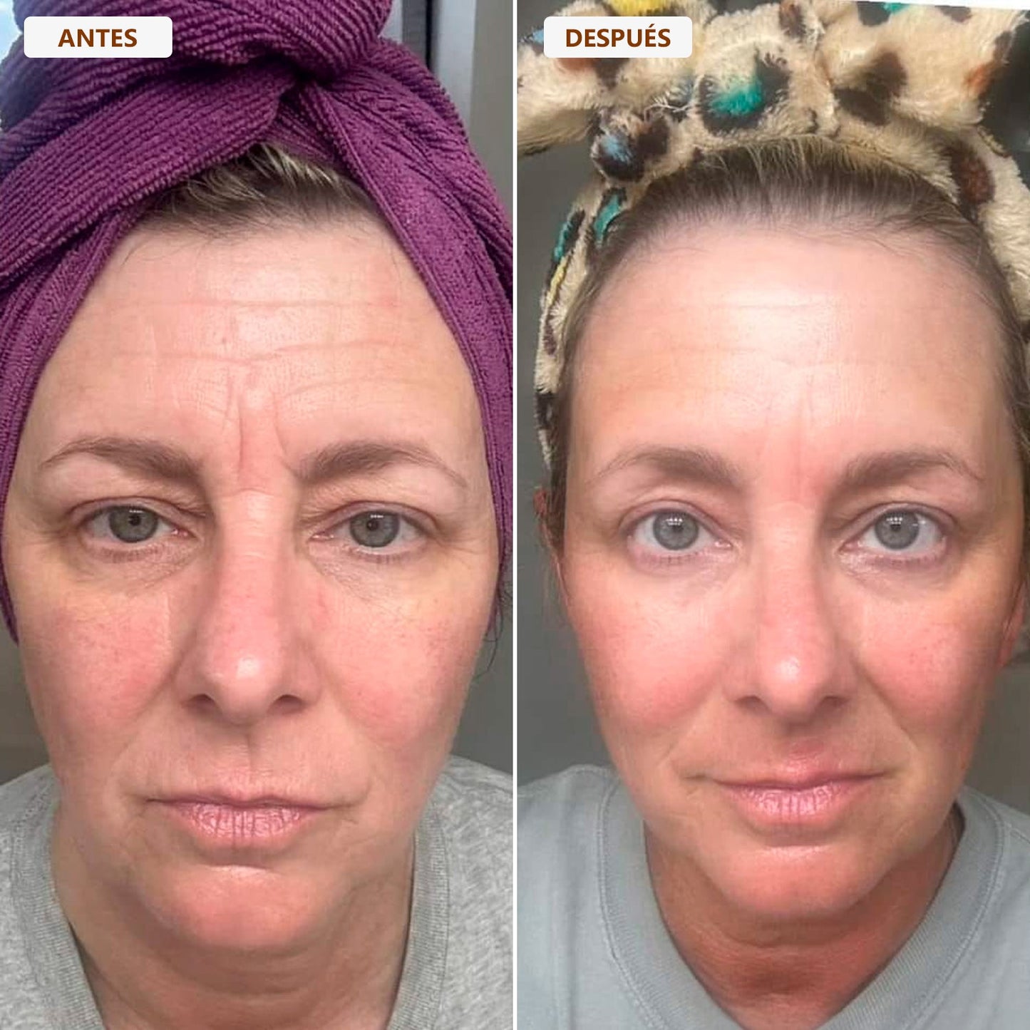 Cepillo drenaje linfático