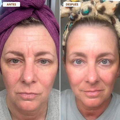 Cepillo drenaje linfático