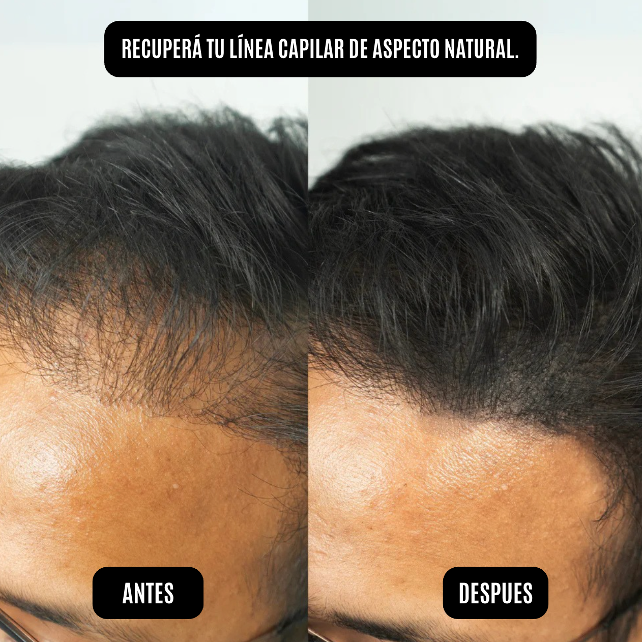 HairGo Bunee - Polvo Capilar Rellenador