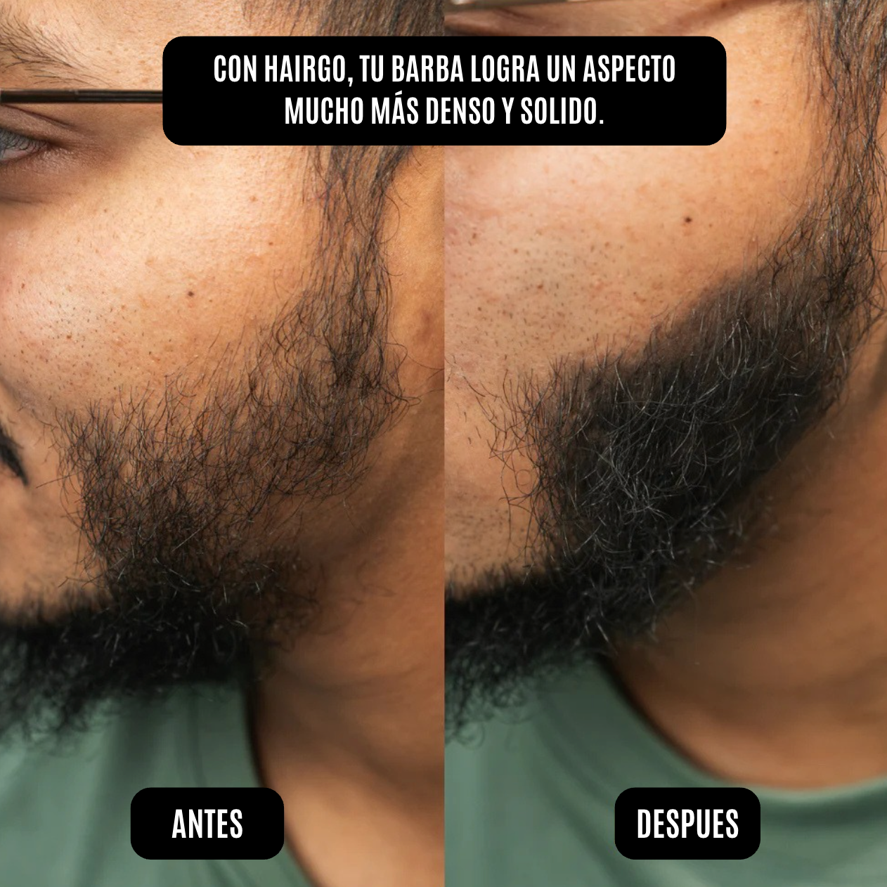HairGo Bunee - Polvo Capilar Rellenador